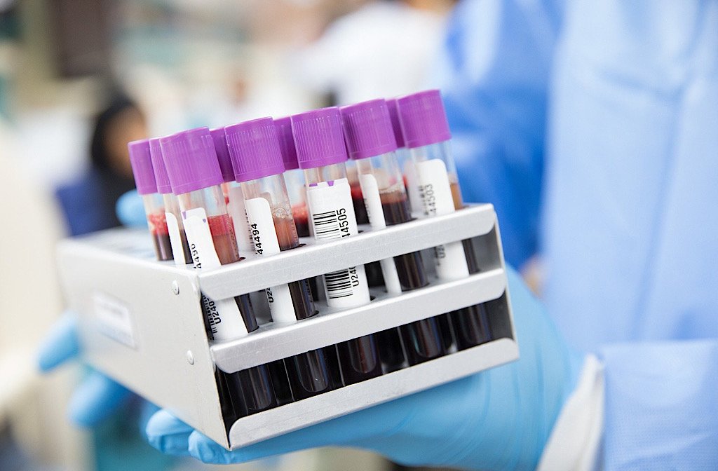 blood test