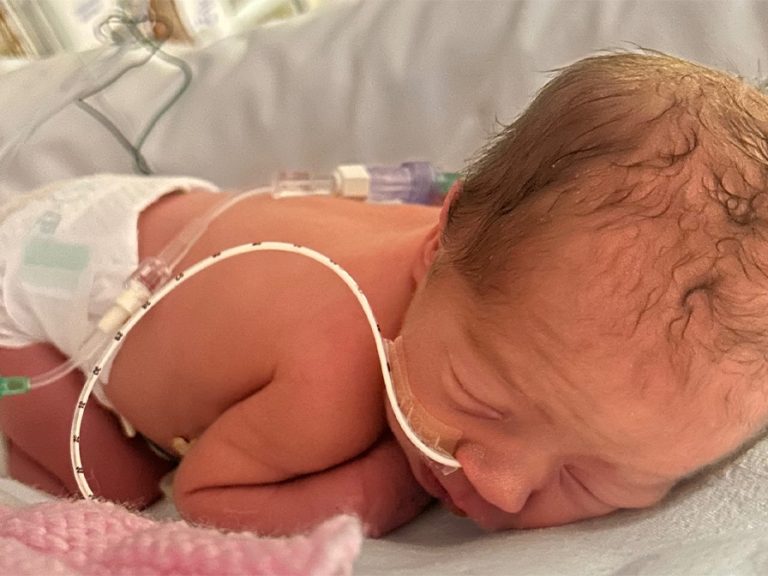 Baby Rosie Robertson in her incubator eight weeks early and weighing only 3lbs. She has wires to monitor her health and is curled up as she sleeps.