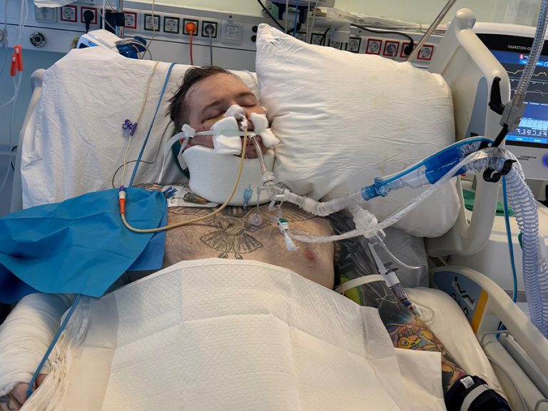Bedford man Lewis Quinn in his ICU bed attached to a respirator. He is critically ill in hospital in Greece. Image: Quinn family/Go Fund Me.