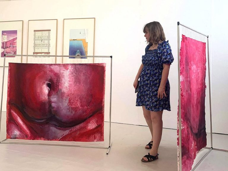 Artist Clare Ellen Gregory alongside her work entitled 'X Marks the Spot'. Her painting is a close up of her stomach which is affected by endometriosis